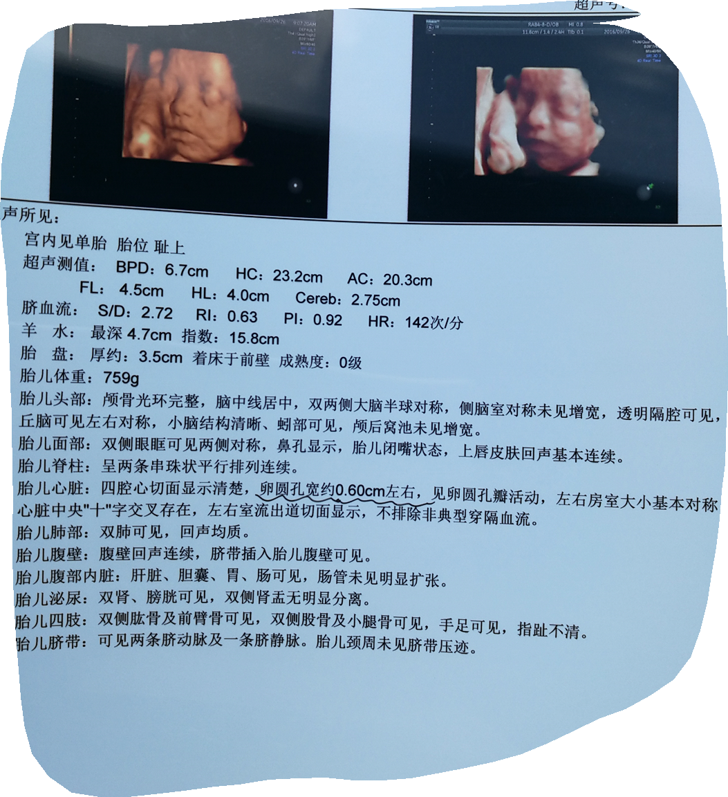 姐妹们接好孕啦～