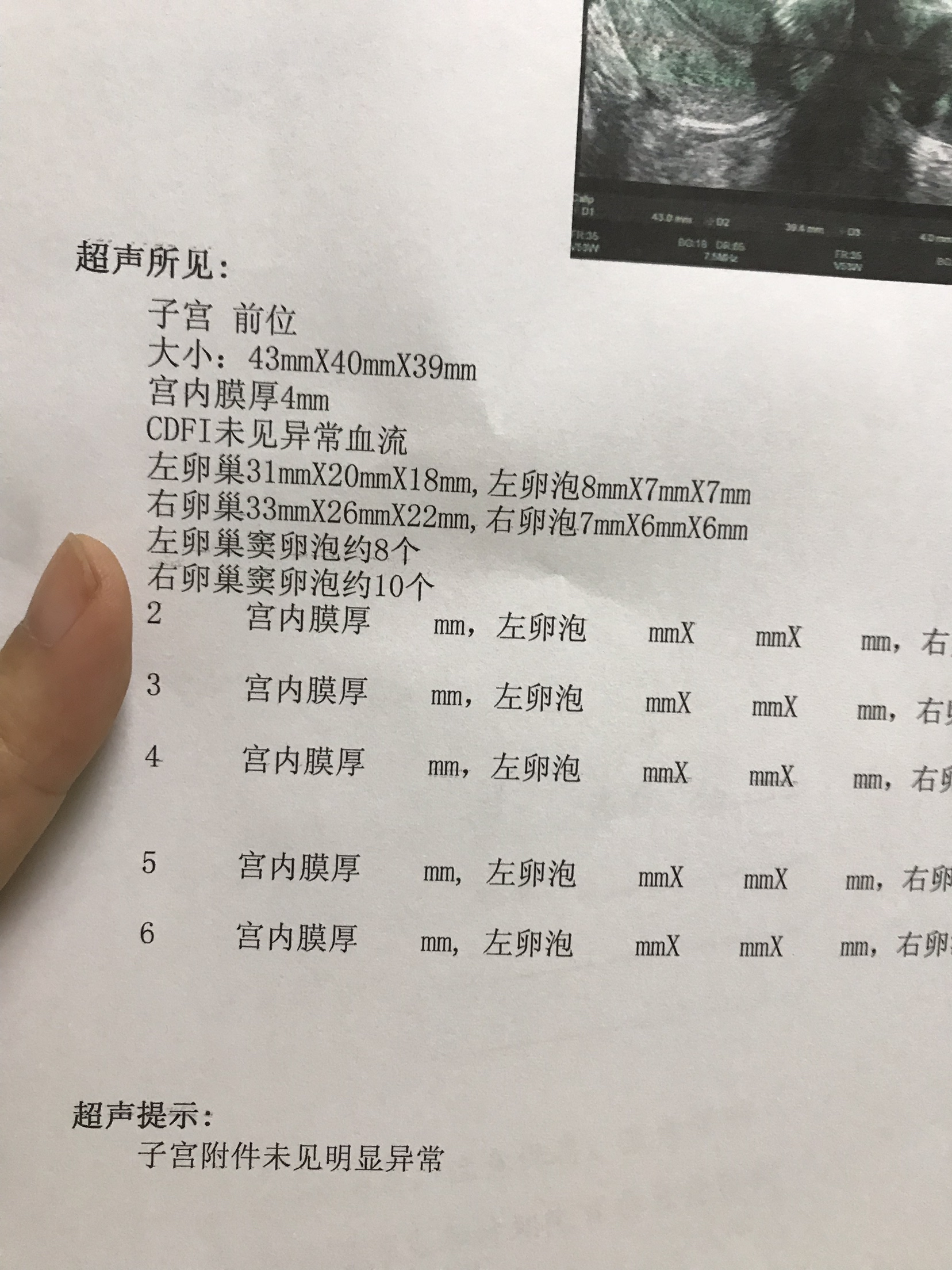 有没有人和我一样多囊呀