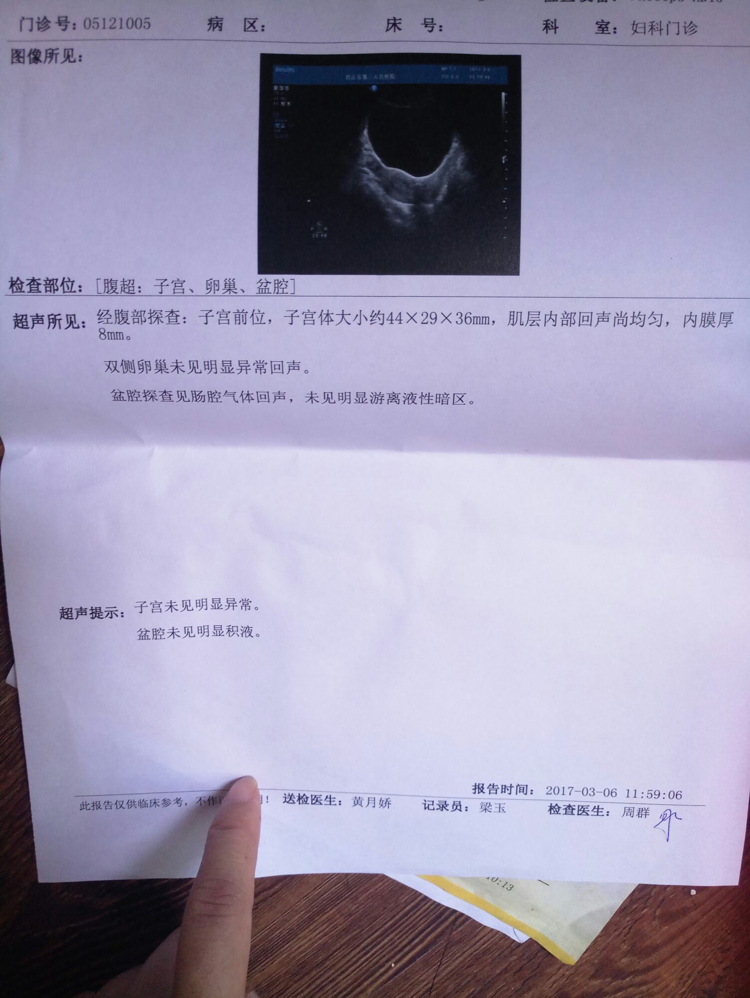 亲们有没有会看的，子宫前位是不是容易受孕呀？