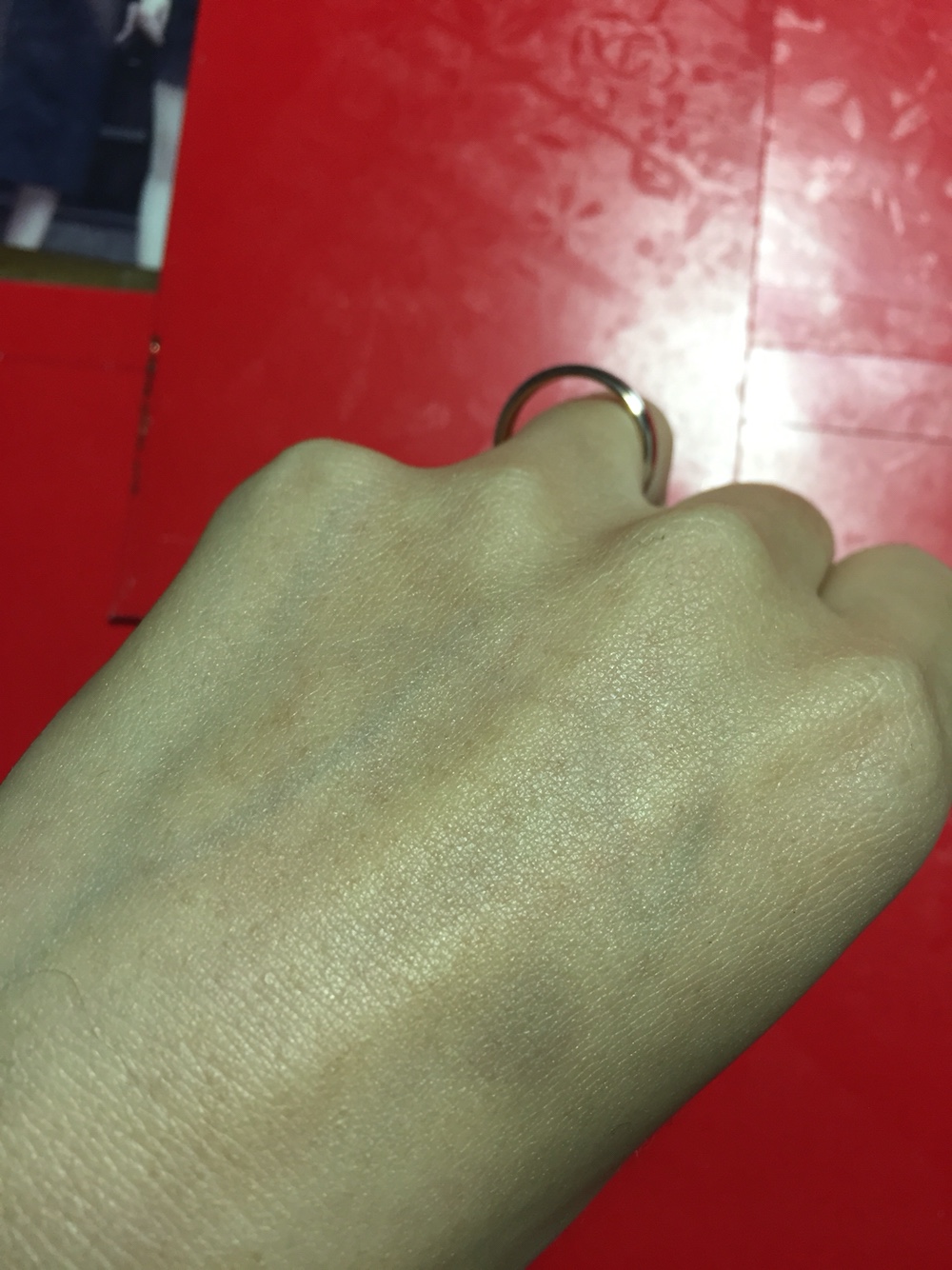 惊呆了！减肥成功婚戒却戴不了！大家忙出招