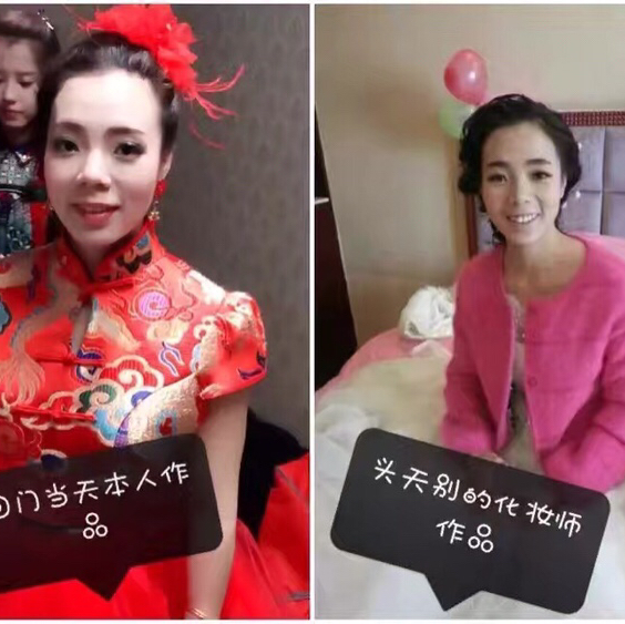 英樹(shù)皮膚管理新娘