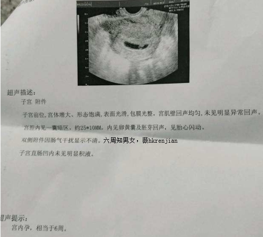 备孕八个月成功，明天六周去香港检测Y-dna