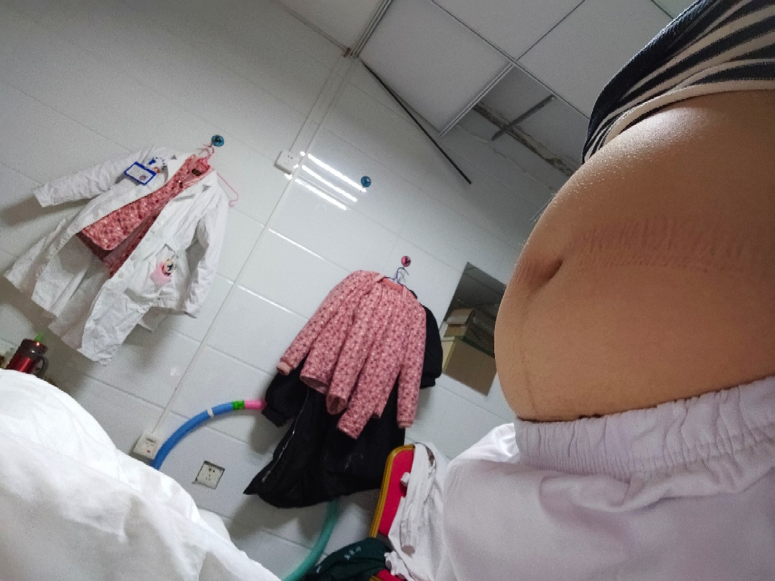 孕4个半月肚子