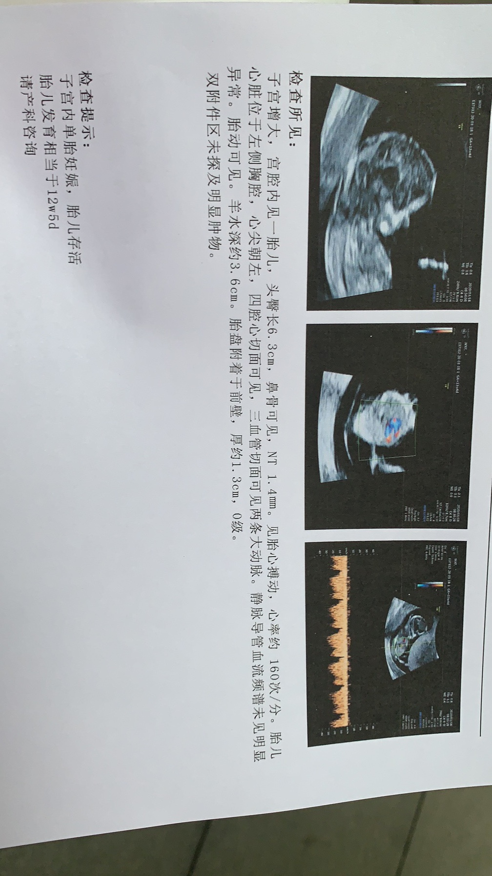 做了NT宝宝👶🏻健康成长