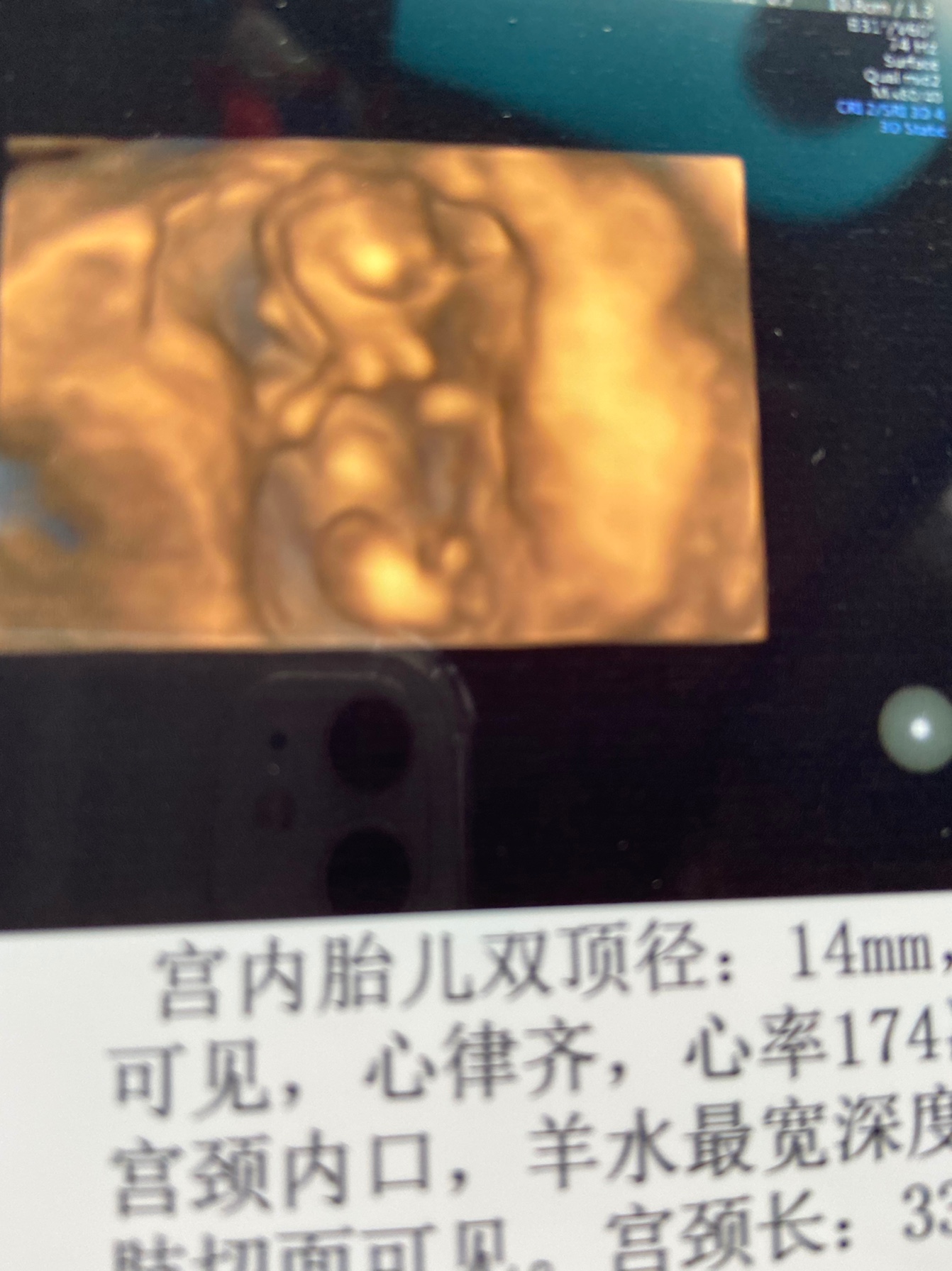 NT一次过