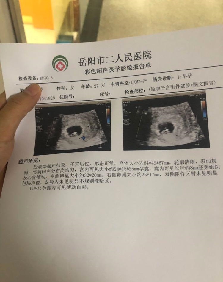 胎心胎芽报道，准备检查，许愿小米妮～