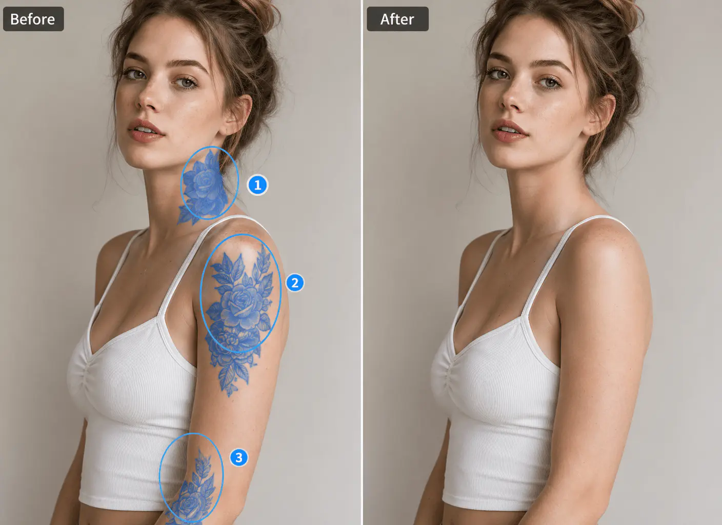 Remove tattoos