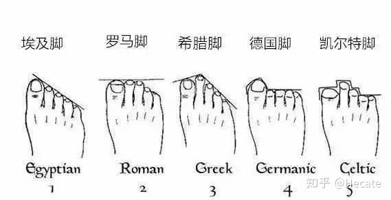 脚型分类